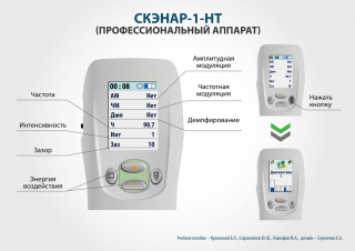 СКЭНАР-1-НТ (исполнение 01)  в Сарапуле купить Медицинская техника - denasosteo.ru 
